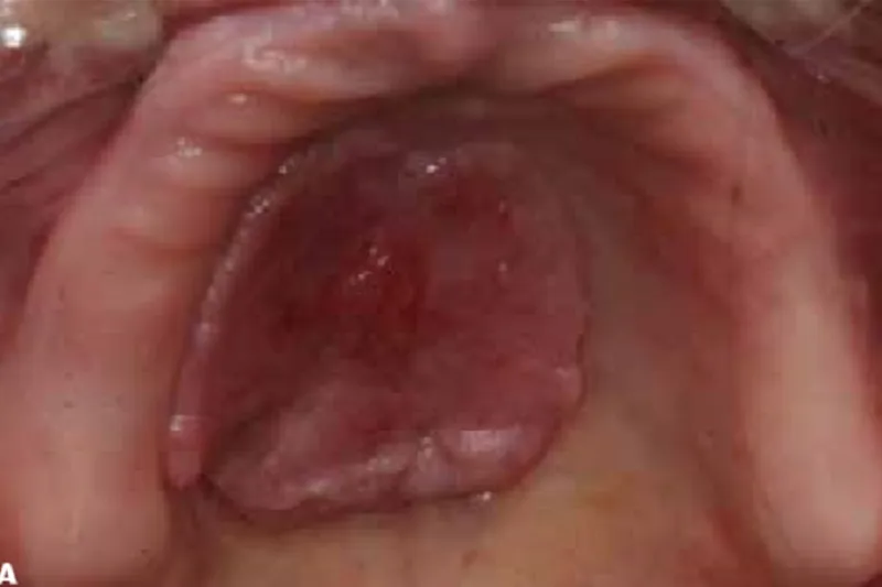 a614 fig