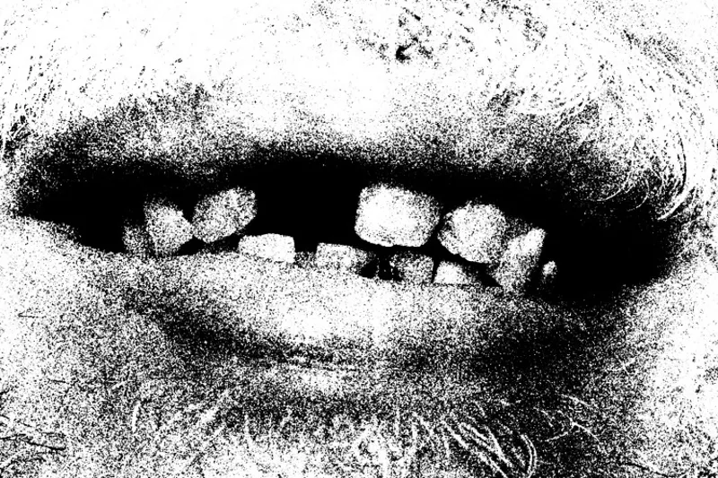 Tandbehandling hjalp kontanthjælpsmodtagere