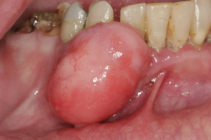 a508 fig. 1