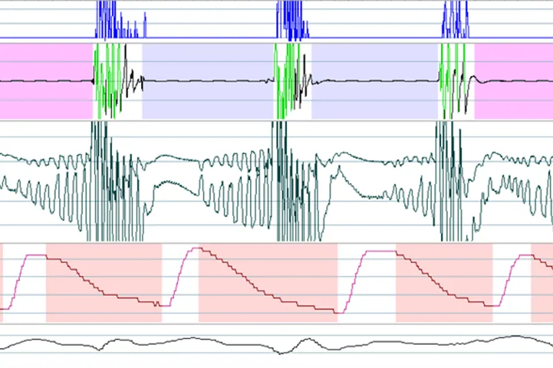 a648 fig.