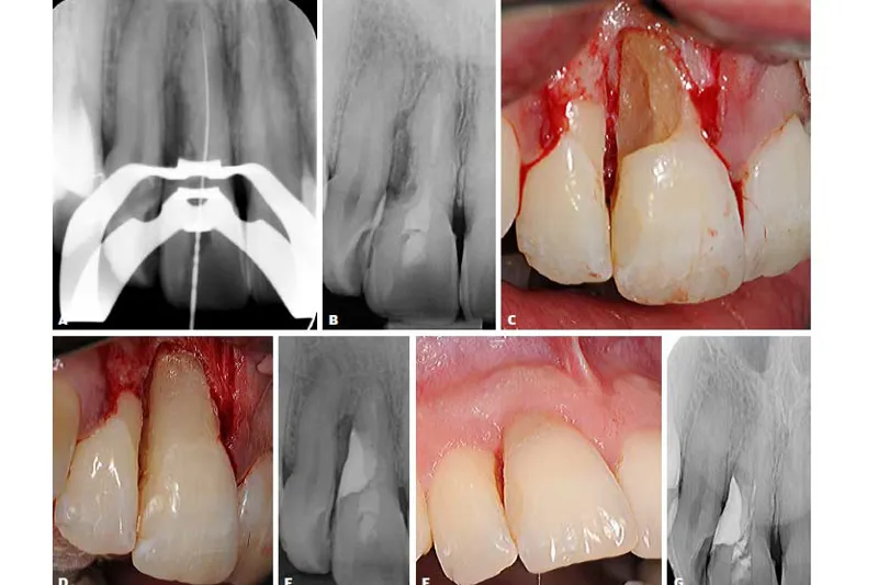 a491 fig. 3