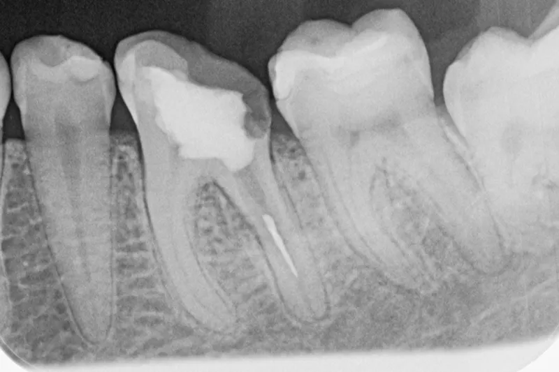 TB2024 09 L├ªr Af Fejlen