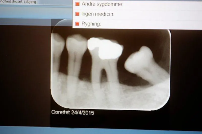 Regenerativ behandling