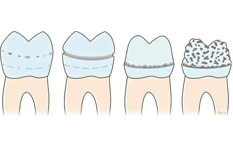 a786 fig.