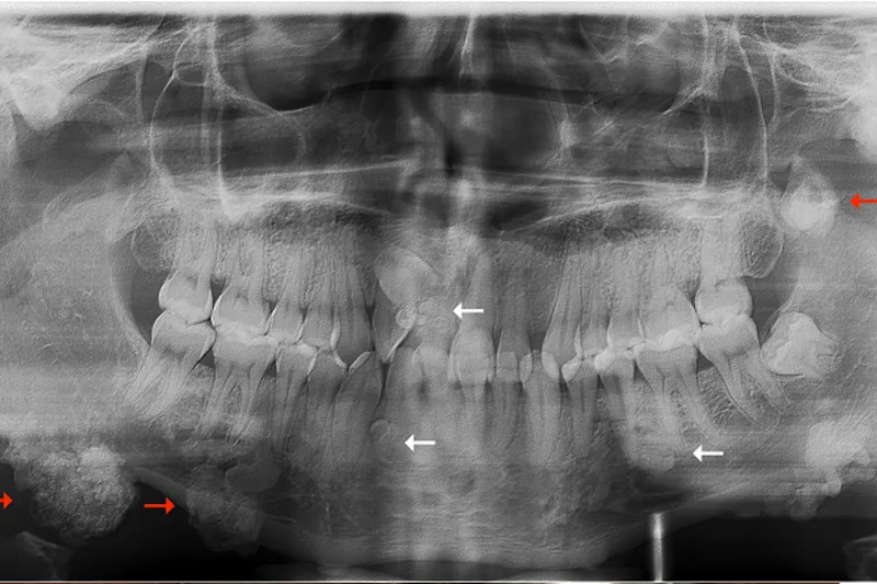 a659 fig.