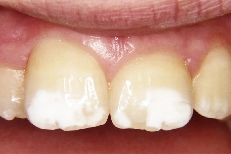 a763 fig.