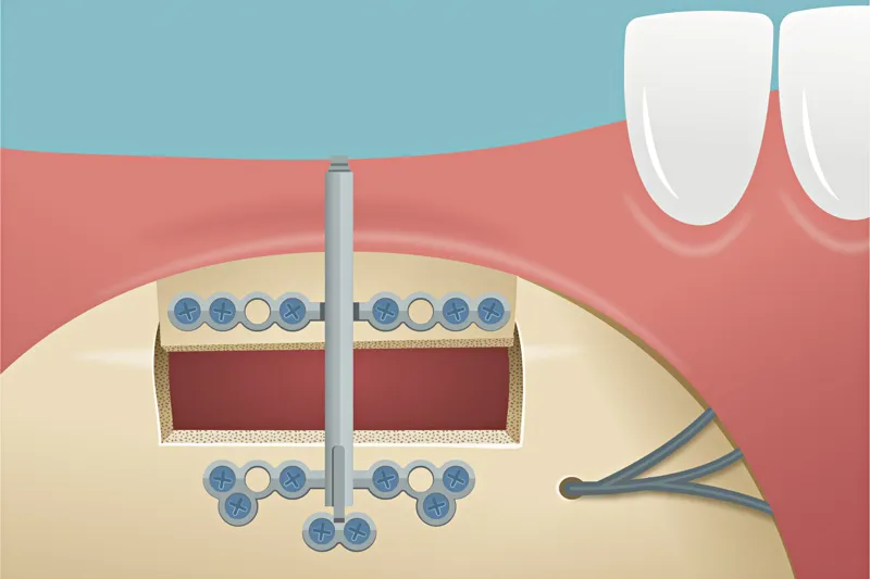 A746 fig. 3