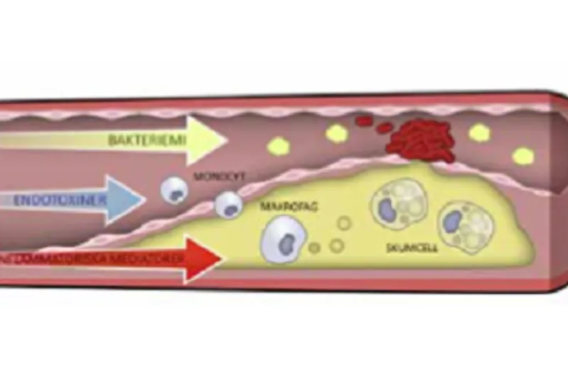 a560 fig.