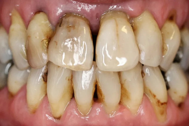 A686 fig. 3