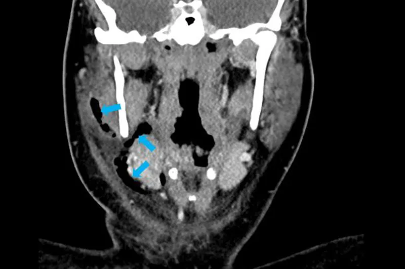 a634 fig.