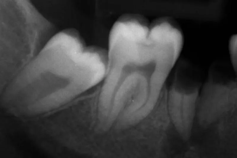 Molar