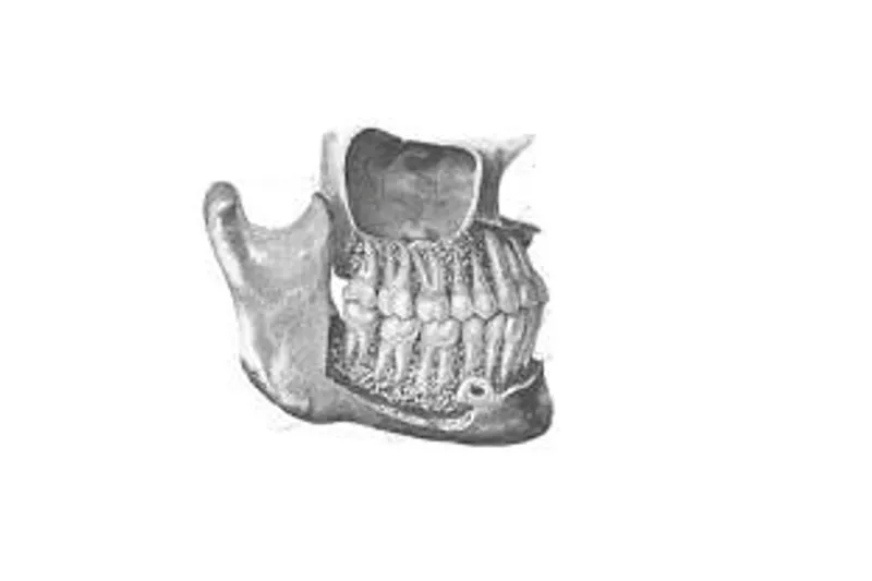 PAN og CBCT